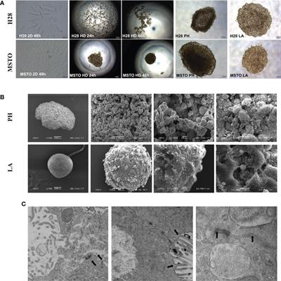 3-Dimensional mesothelioma spheroids provide closer to natural pathophysiological tumor microenvironment for drug response studies